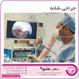 جراحی شانه دکتر مصطفی علوی