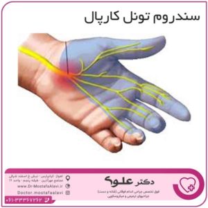 جراحی دست در اهواز دکتر مصطفی علوی